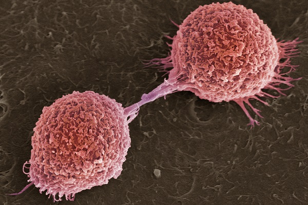 Barts Cancer Institute